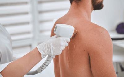 7 Proven Benefits of Professional Hair Removal for Men