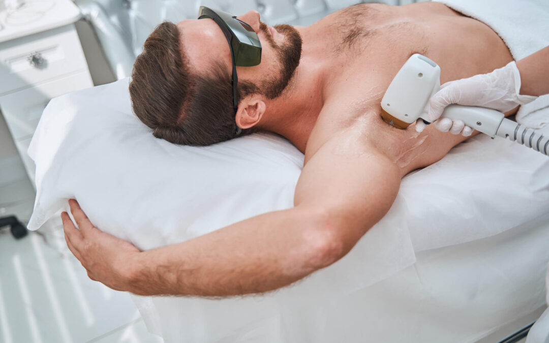 5 Reasons Why Laser Hair Removal for Men in New York is a Game-Changer